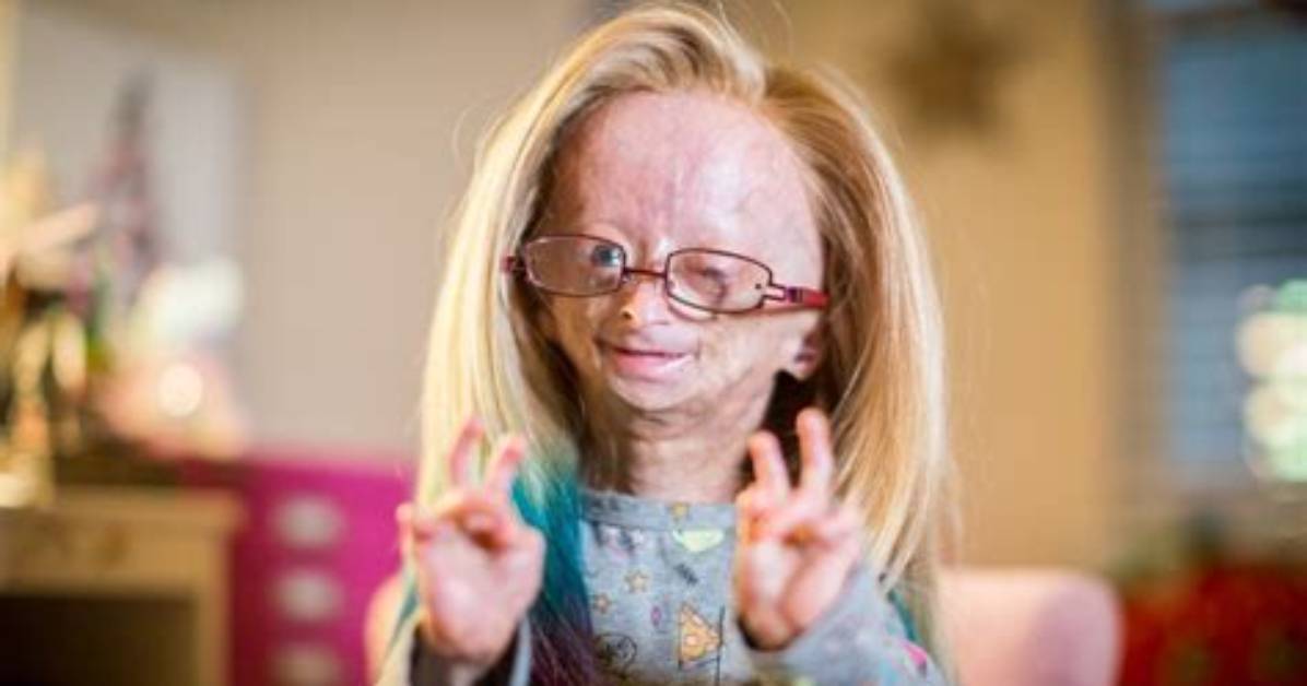 Adalia Rose