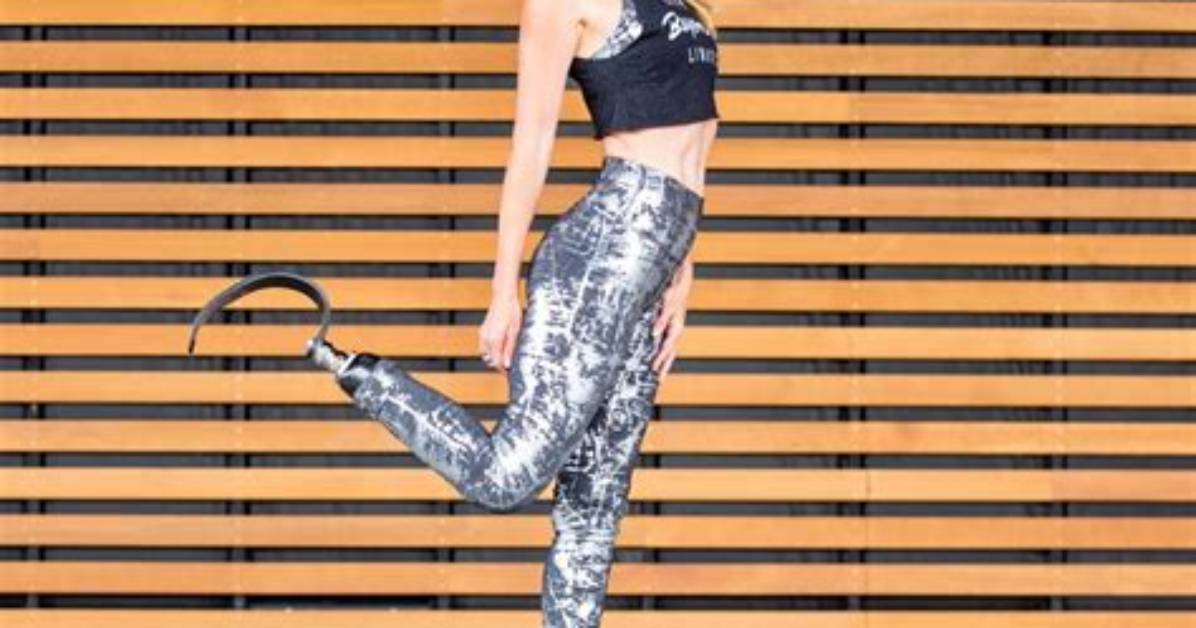 Amy Purdy