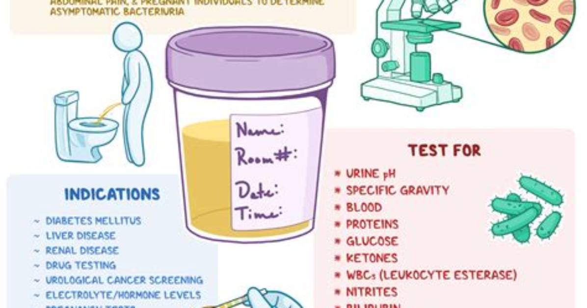 An I Refuse a Urine Test? Check It out – Can You Refuse a Urine Test at the Doctors