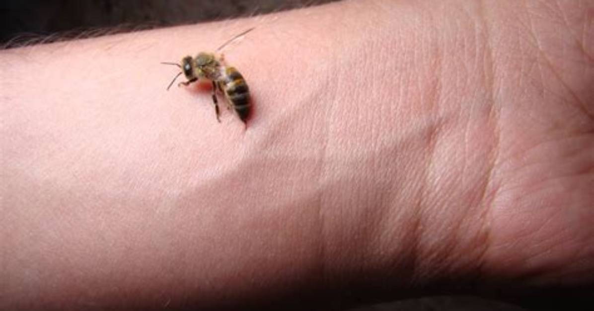Are Bee Sting Good?