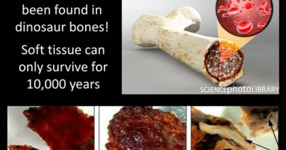Are Bones Soft Tissue?