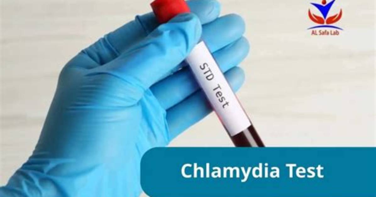 Are Chlamydia Tests Accurate?