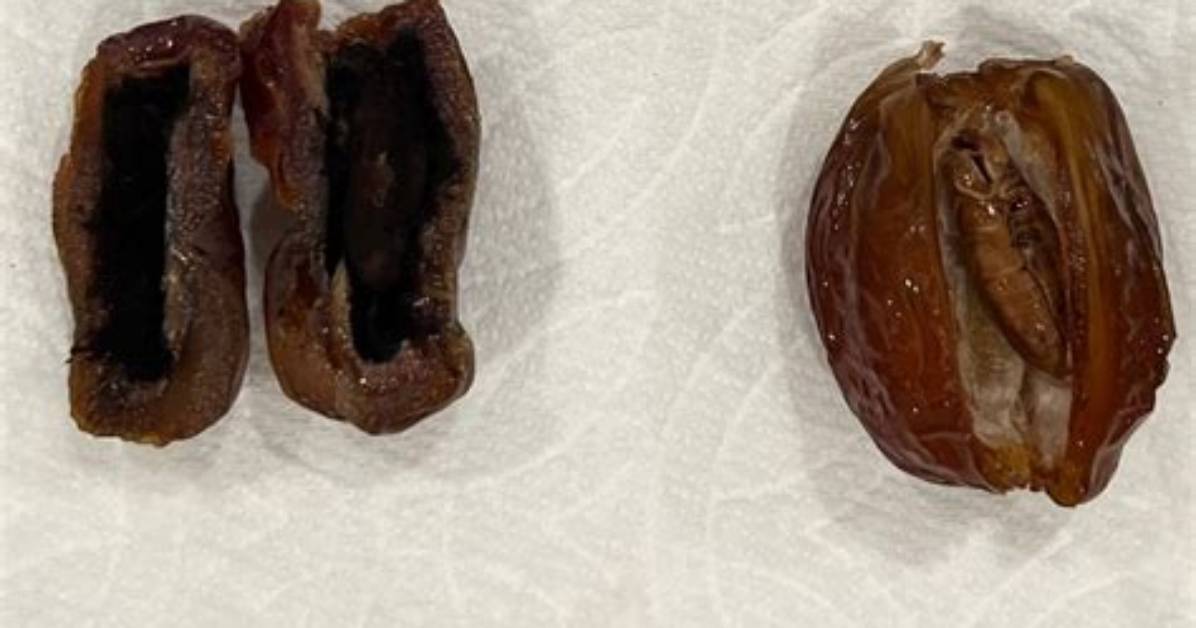 Are Dates as Bad as Sugar