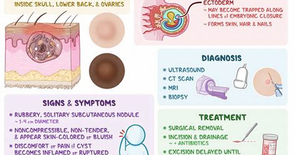 Are Dermoid Cysts Common?