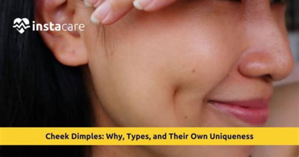 Are Dimples Face Deformities?