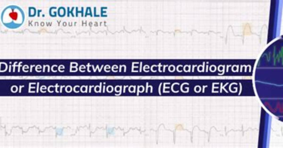 Are Electrocardiogram and Electrocardiograph Same?