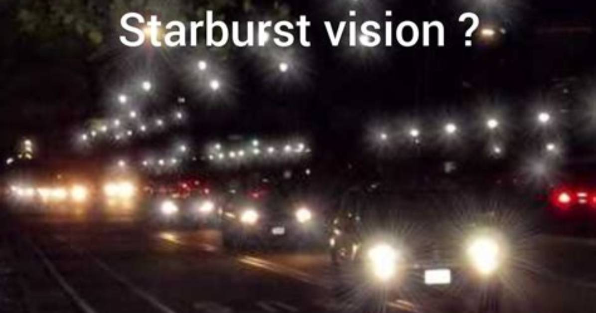 Are Eye Starbursts Normal?