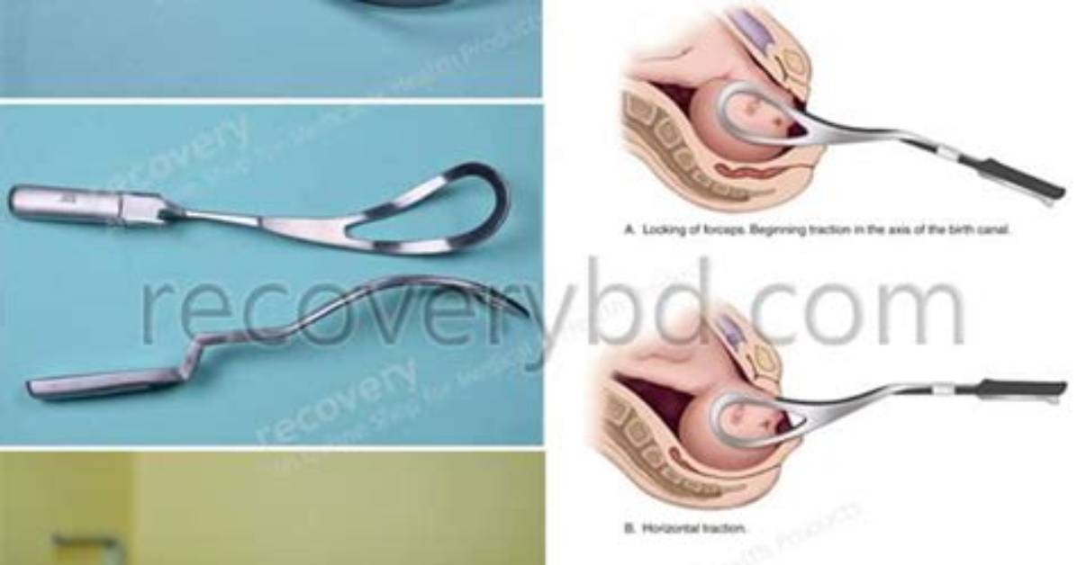 Are Forceps Safe in Delivery?