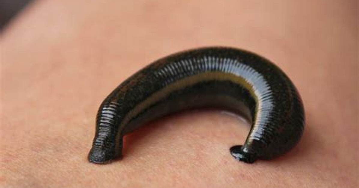 Are Leeches Painless