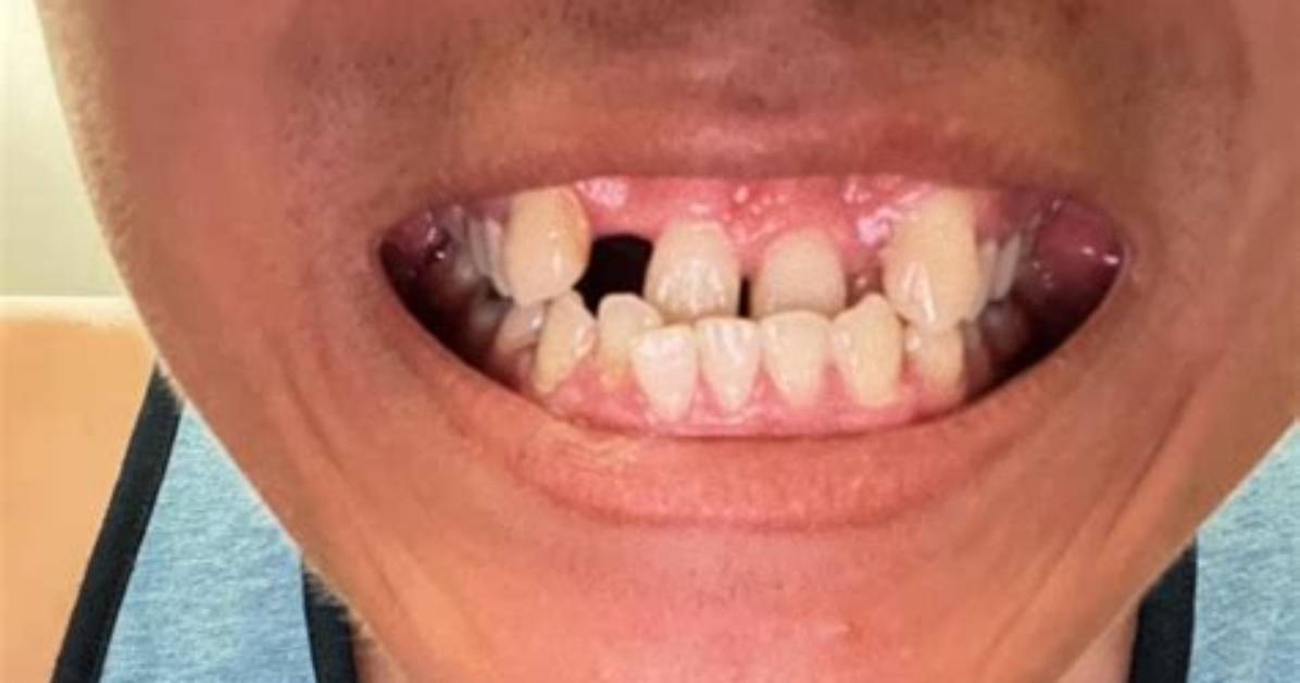 Are My Teeth Fixable?