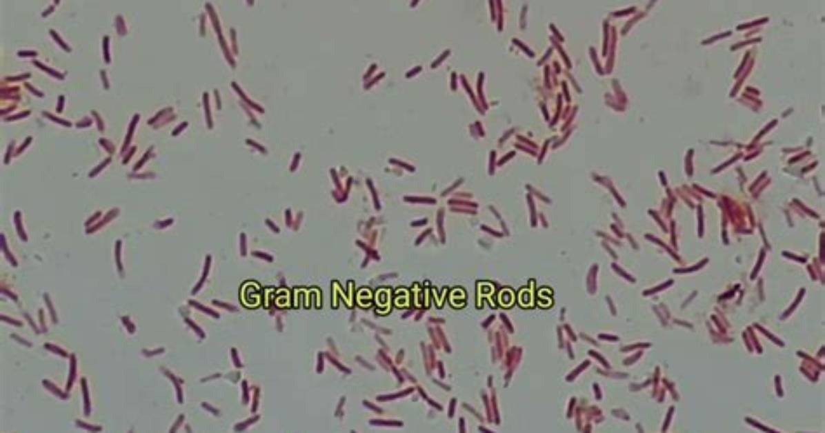 Are Rods Gram Negative