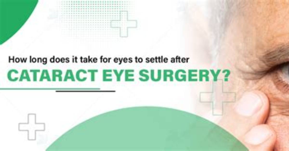 Are Shadows Normal After Cataract Surgery?