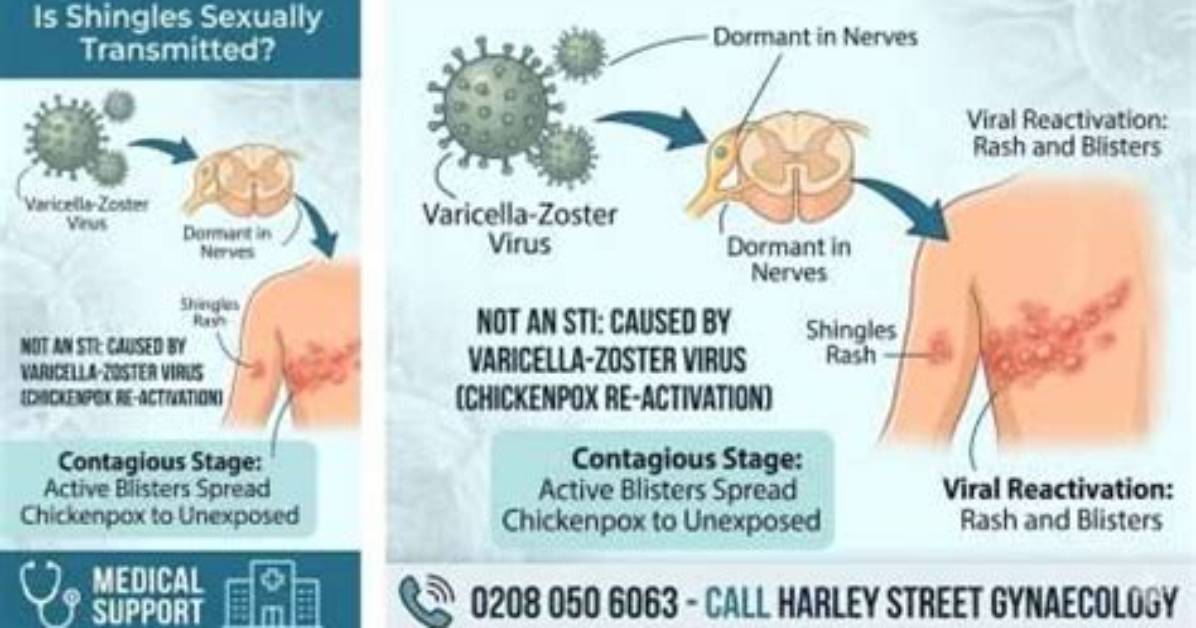 Are Shingles Sexually Transmitted?