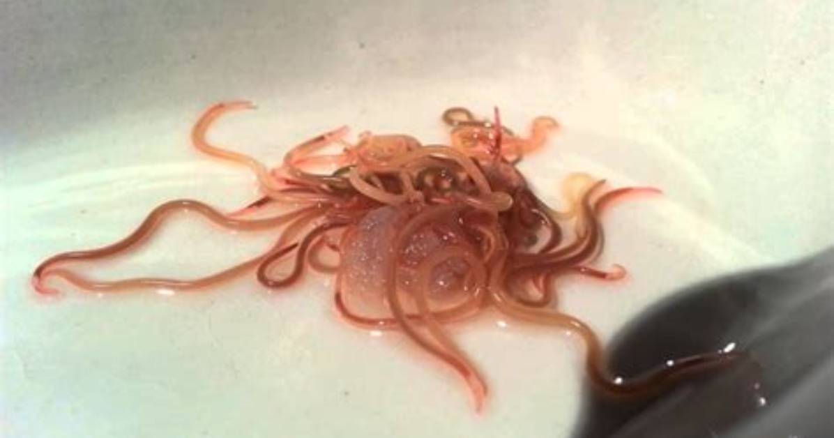 Are There Worms in Codfish?