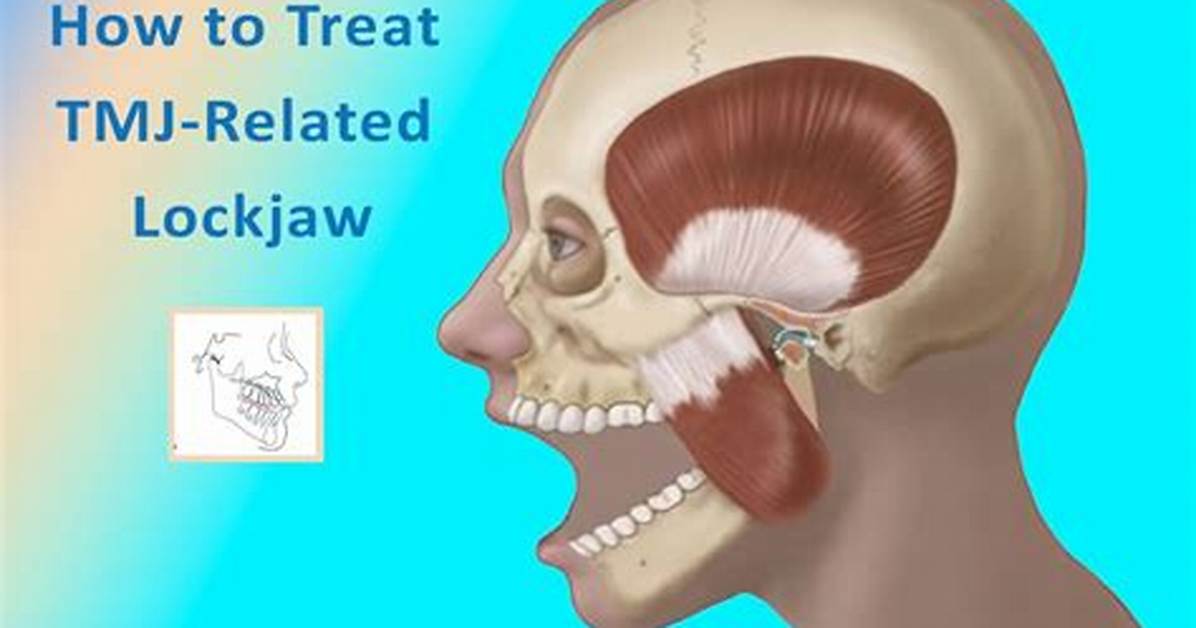 Are Tmj and Lockjaw the Same?