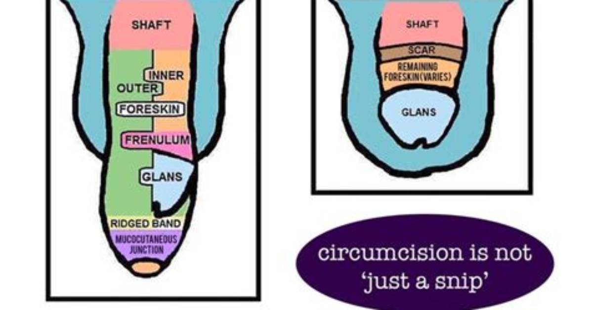 At What Age Does an Uncircumcised?