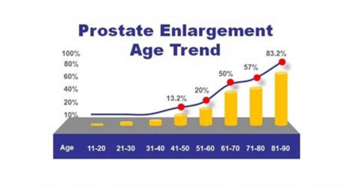 At What Age Does Prostate Enlargement Usually Begin?
