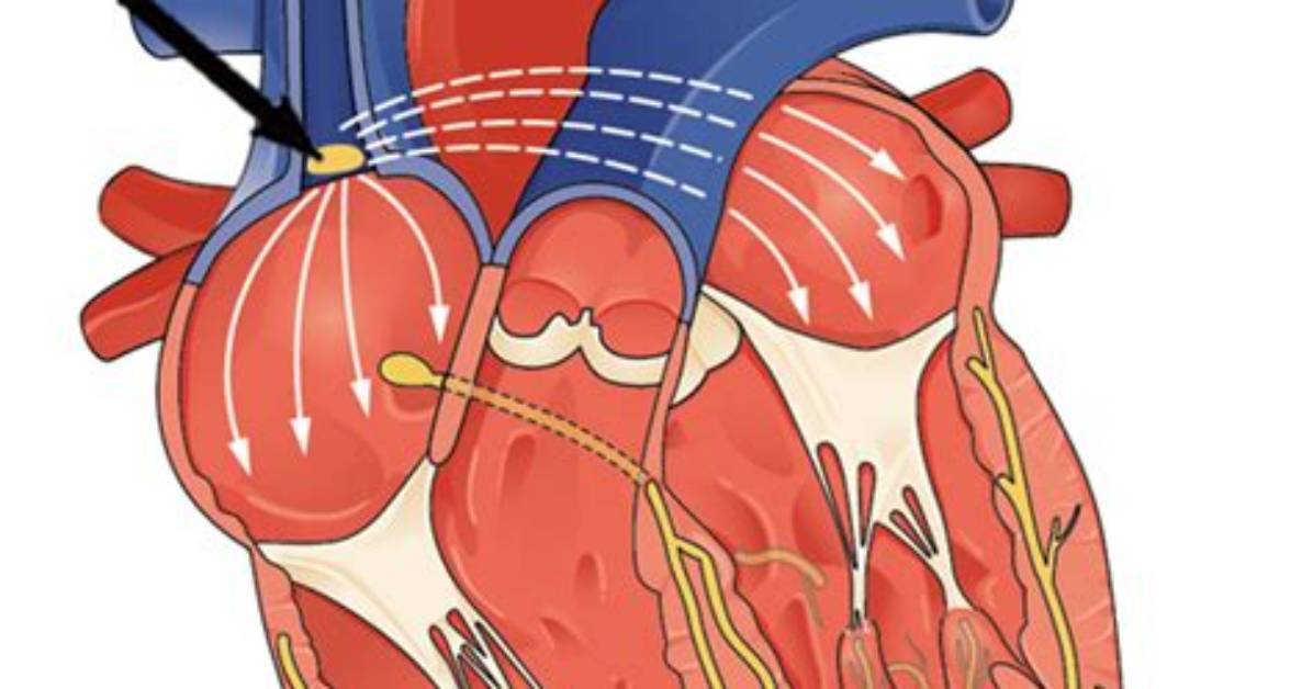 At What Rate Does the Sinoatrial Node Depolarize?
