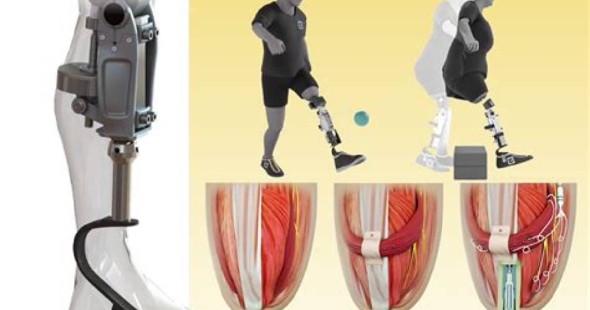 Barnacle Prosthetic: Revolutionizing Limb Replacement for Amputees