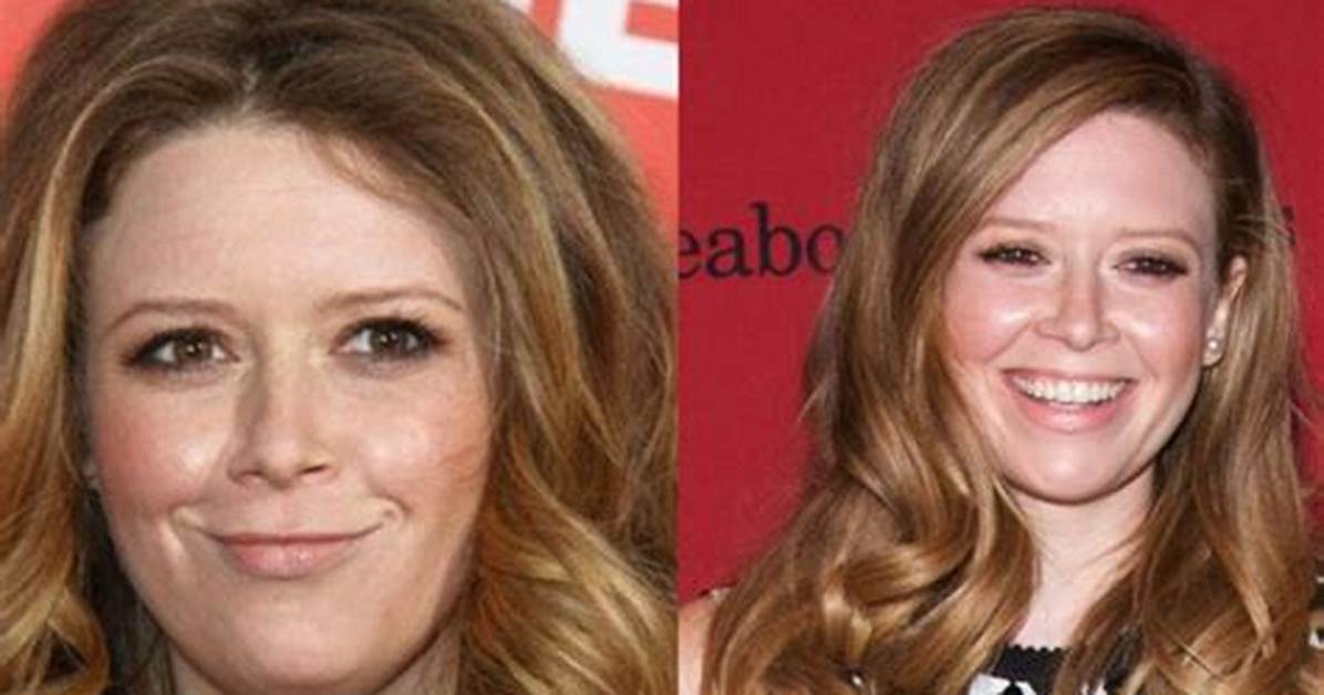 Behind Natasha Lyonne’s Plastic Surgery Claims