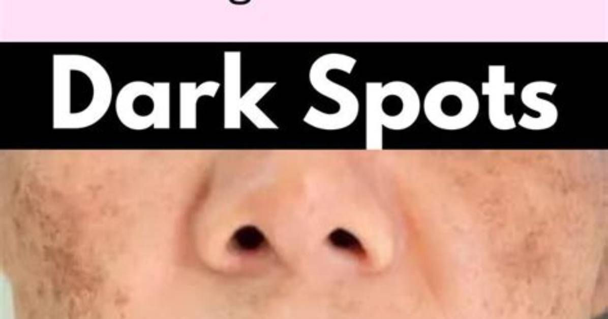Best Answer: How Do You Get Dark Pie on Android?