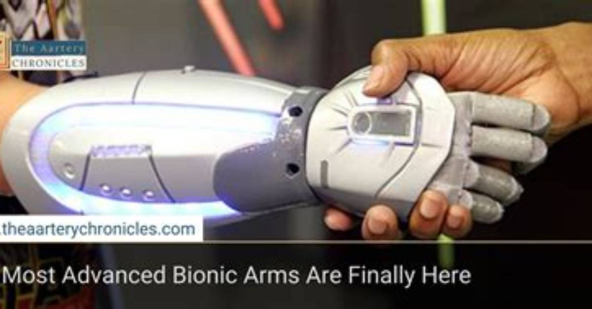 Bionic Arm - How to Discuss
