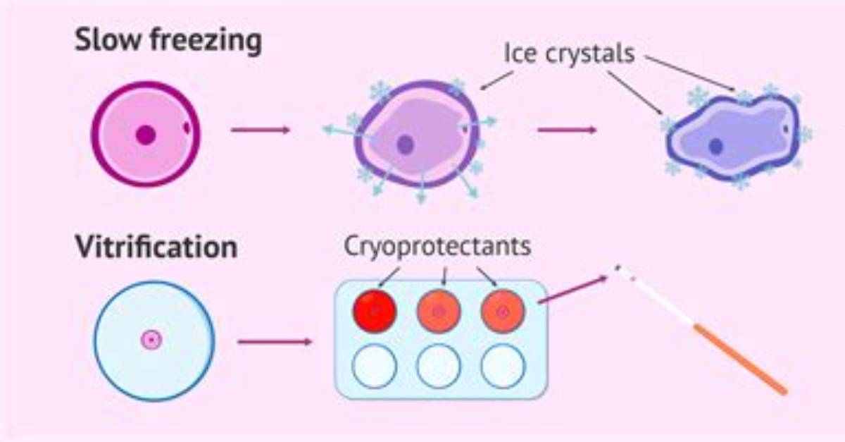 By the Vitrification Method?