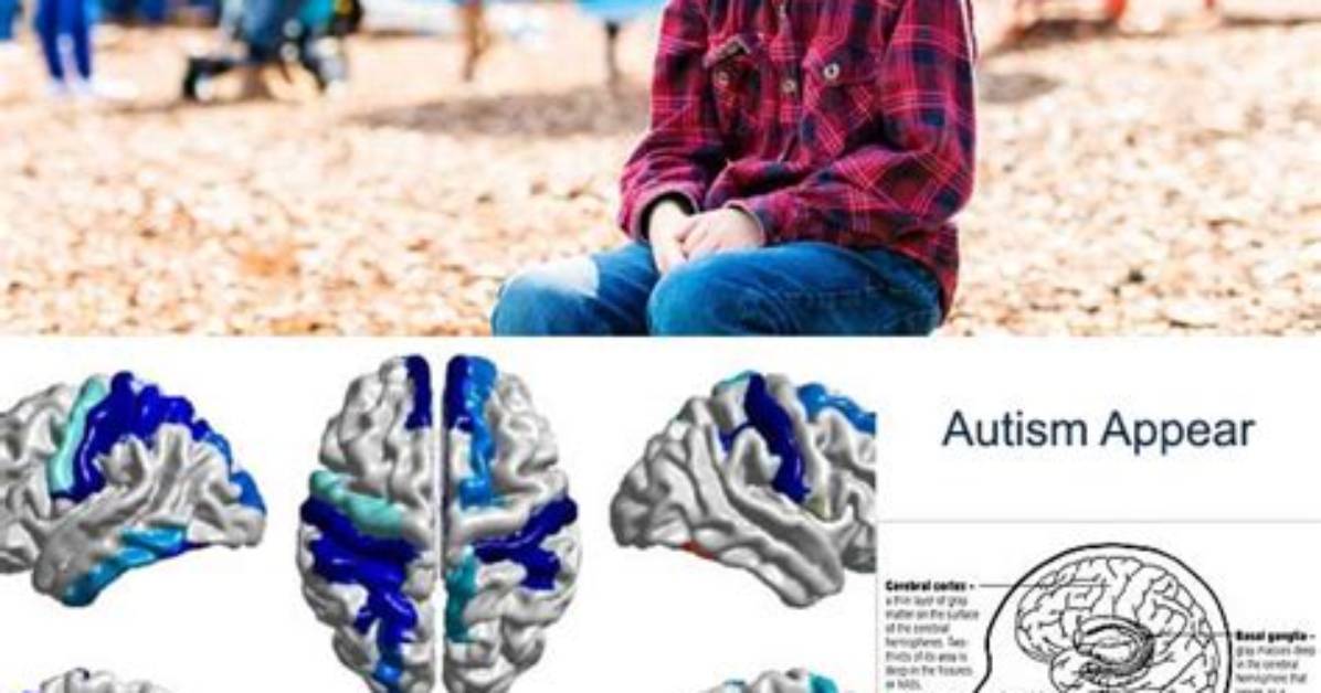 By What Age Does Autism Appear?
