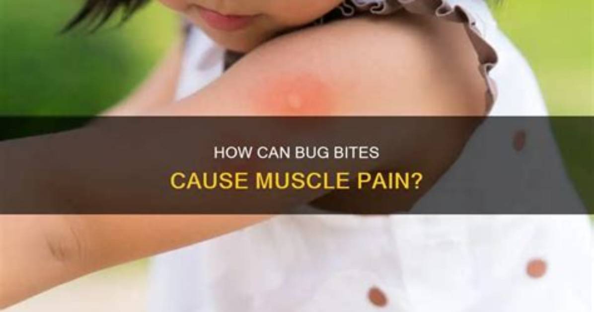 Can a Bug Bite Cause Muscle Pain?