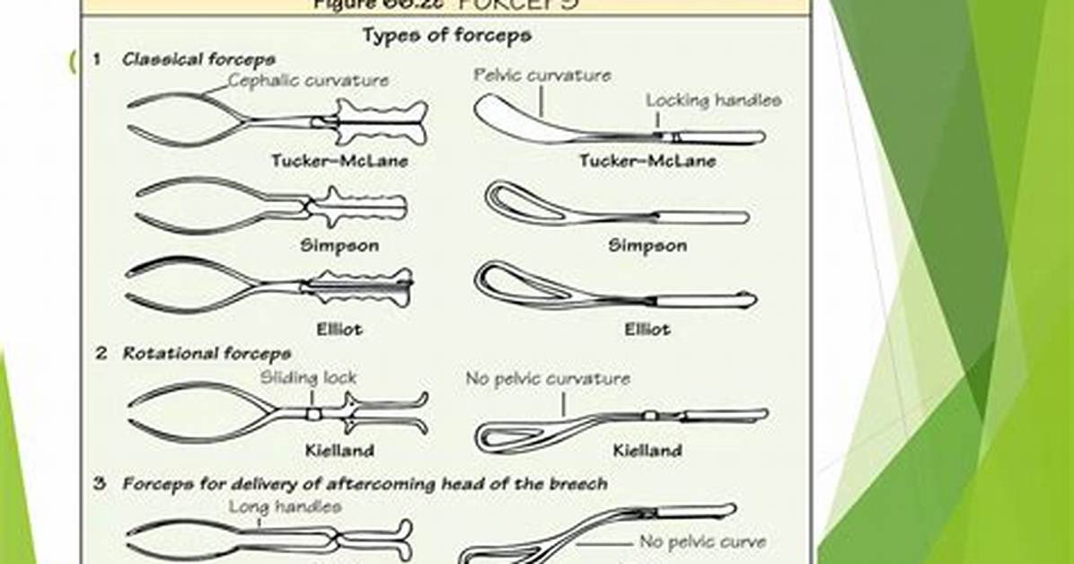 Can a Forceps Delivery Cause Problems?