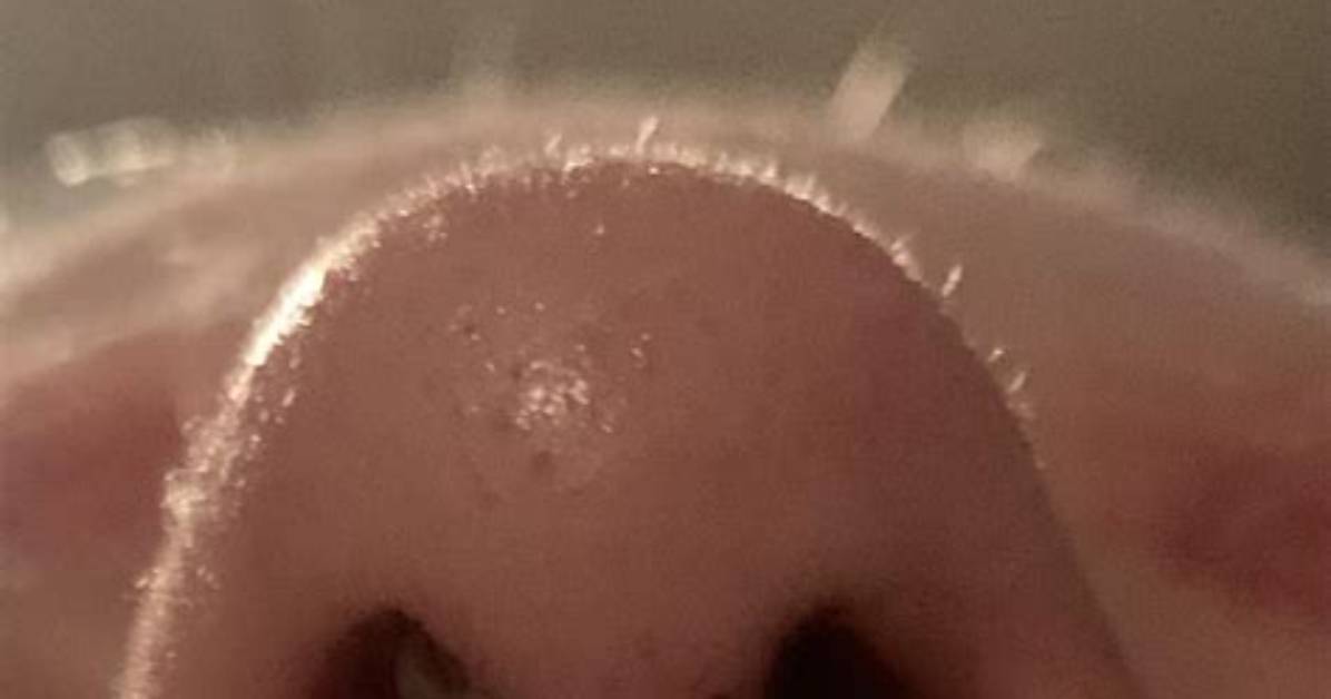 Can a Septum Ring Be Too Small?