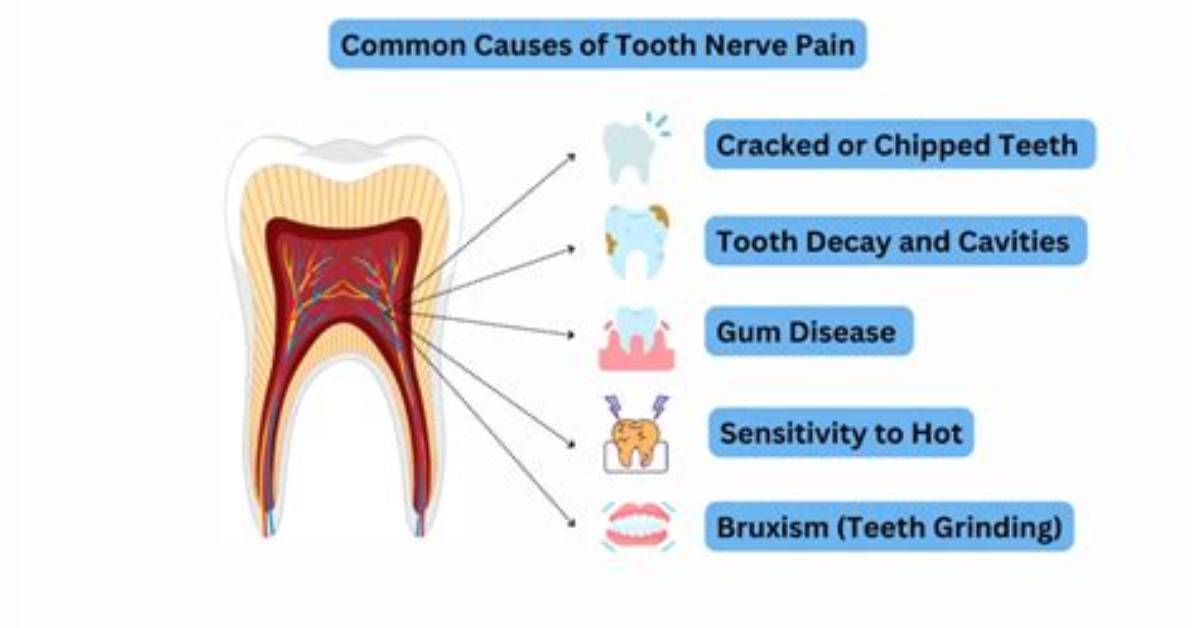 Can a Tooth Nerve Calm Down?