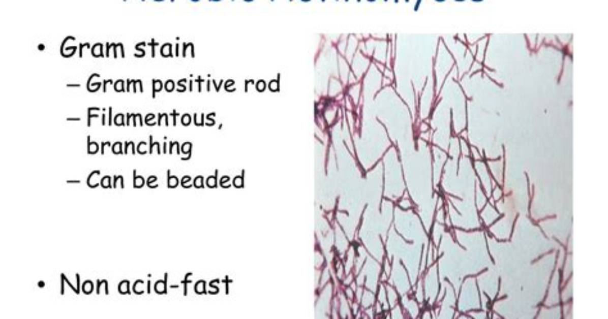 Can Actinomyces Grow Aerobically?