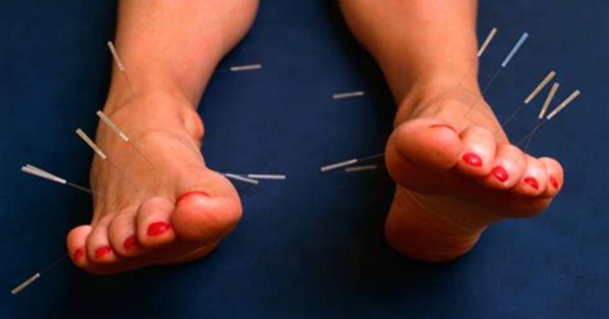 Can Acupuncture Help Sprained Ankle?