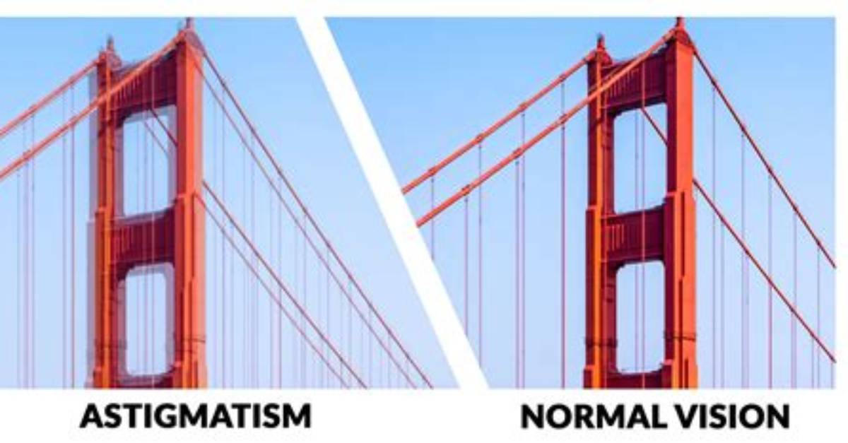 Can Astigmatism Cause Double Vision?