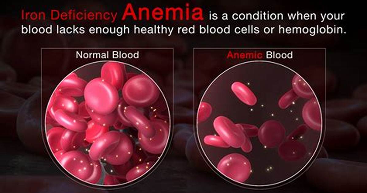 Can Avoid Iatrogenic Anemia?