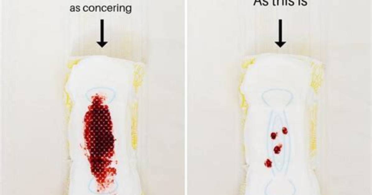 Can Bleeding Be Ok During Pregnancy?