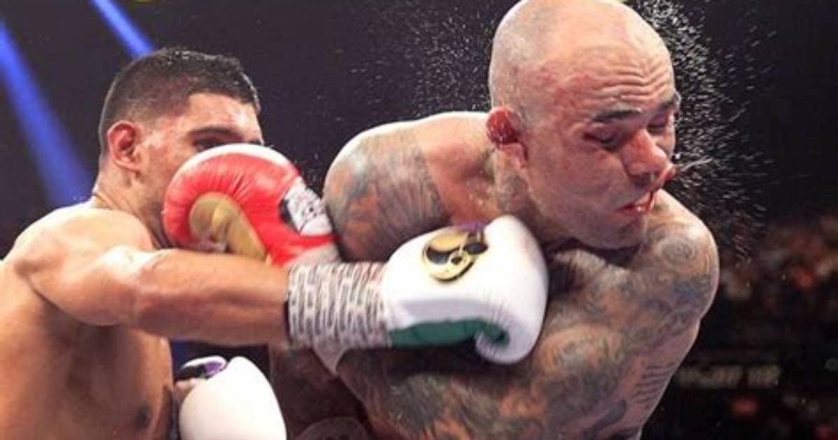 Can Boxing Cause Brain Damage?