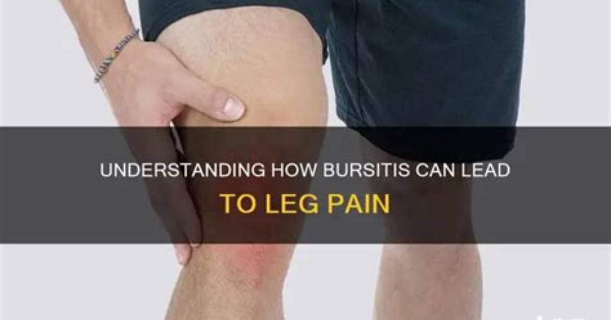 Can Bursitis Be Cured?