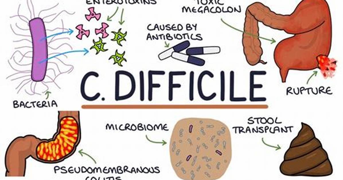 Can C Difficile Come Back?