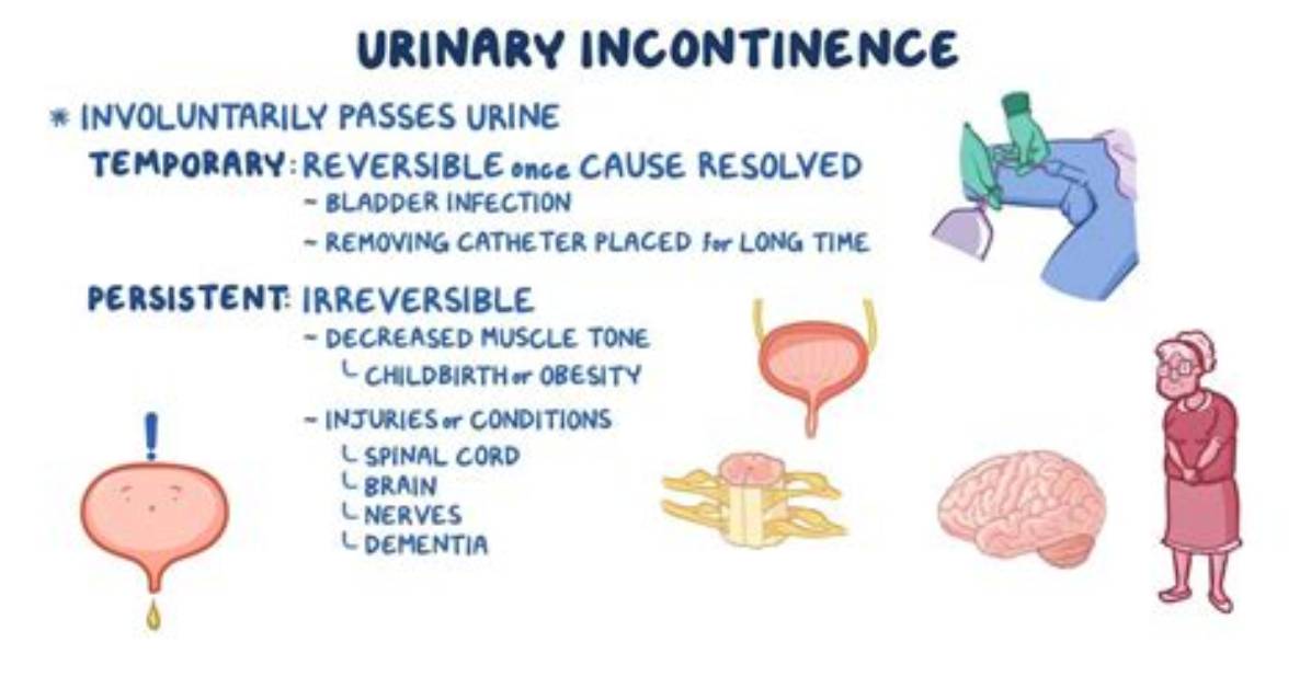 Can Catheterization Cause Incontinence?