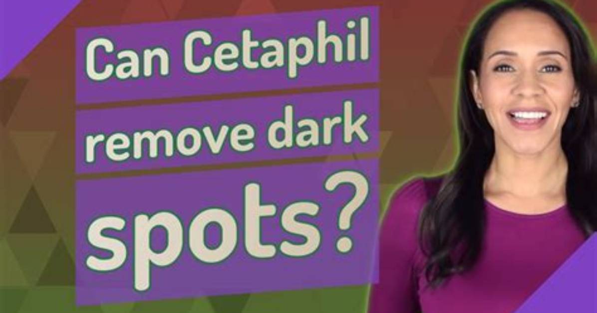 Can Cetaphil Remove Dark Spots?
