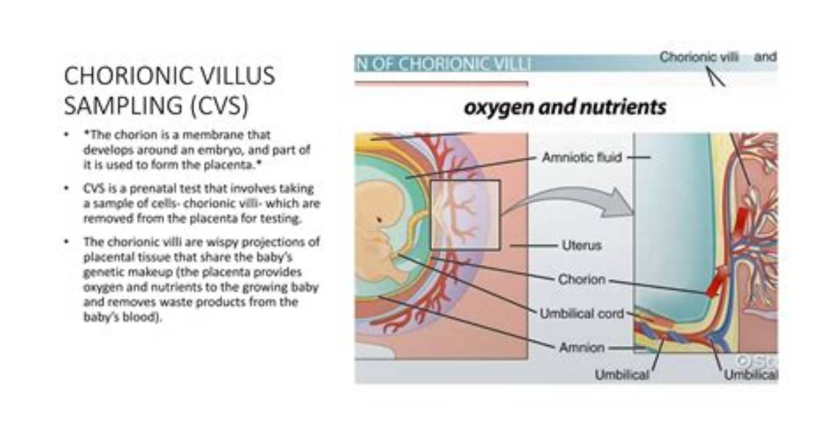 Can Chorionic Villus Sampling Cause a Miscarriage?