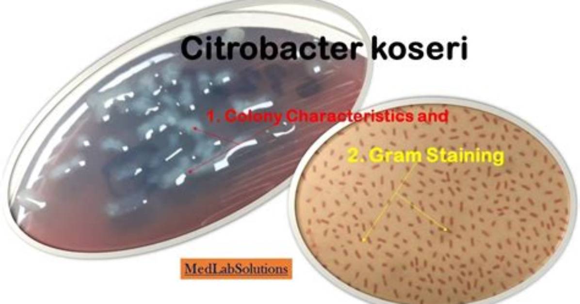 Can Citrobacter Koseri Kill You?