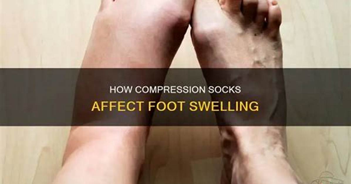 Can Compression Socks Cause Swelling?