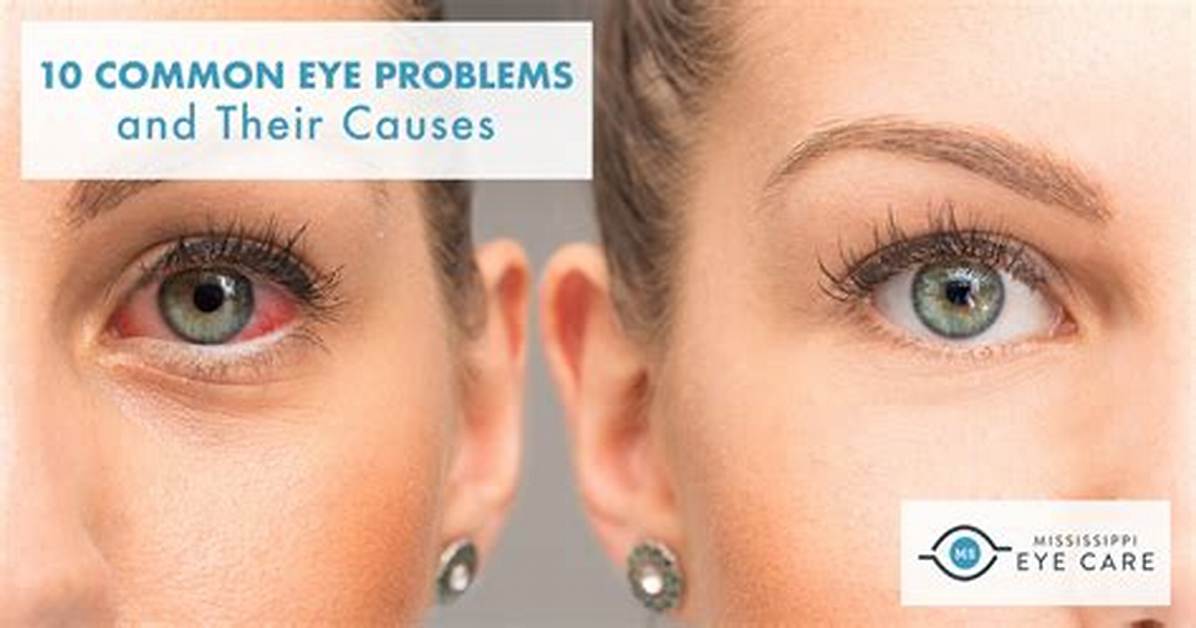 Can Cosentyx Cause Eye Problems?