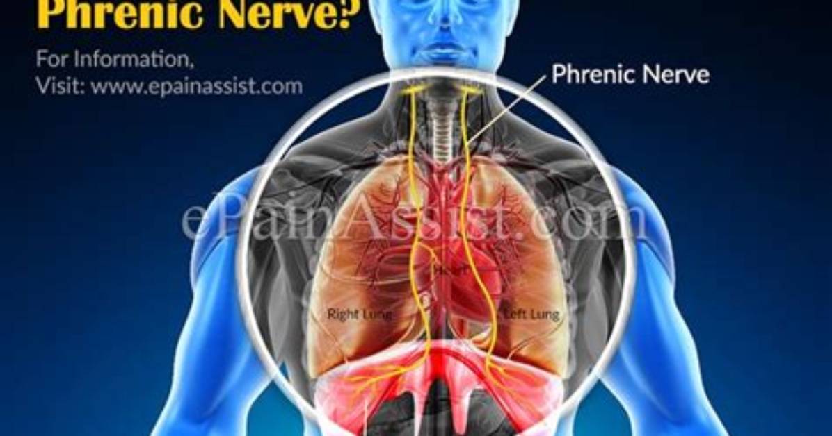 Can Covid Damage Phrenic Nerve?