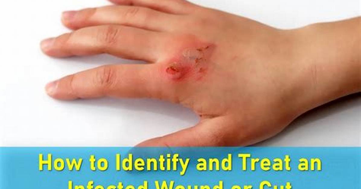 Can Cuts Get Infected?