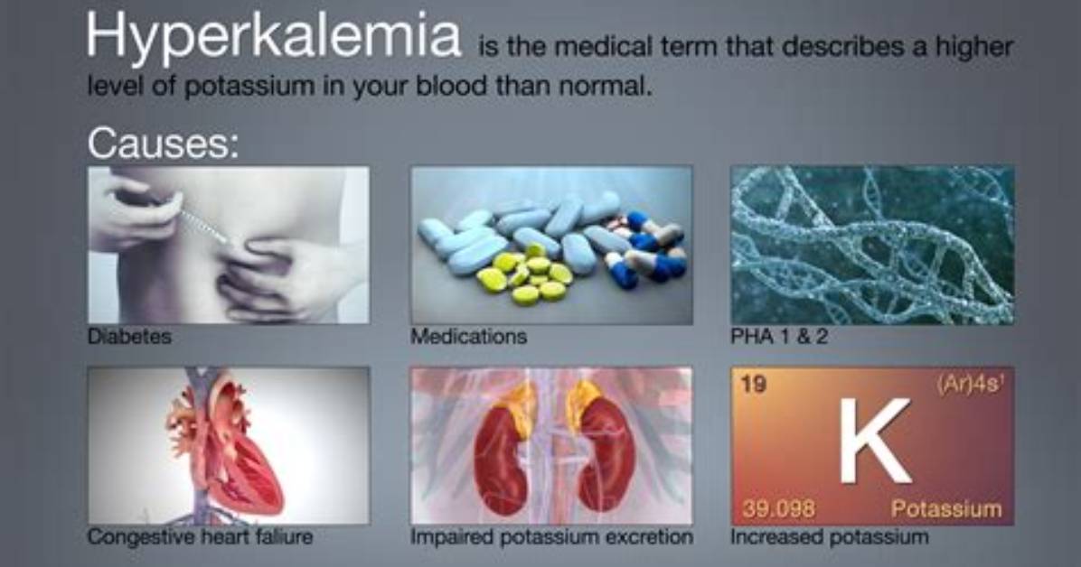 Can Depolarization Cause Hyperkalemia?