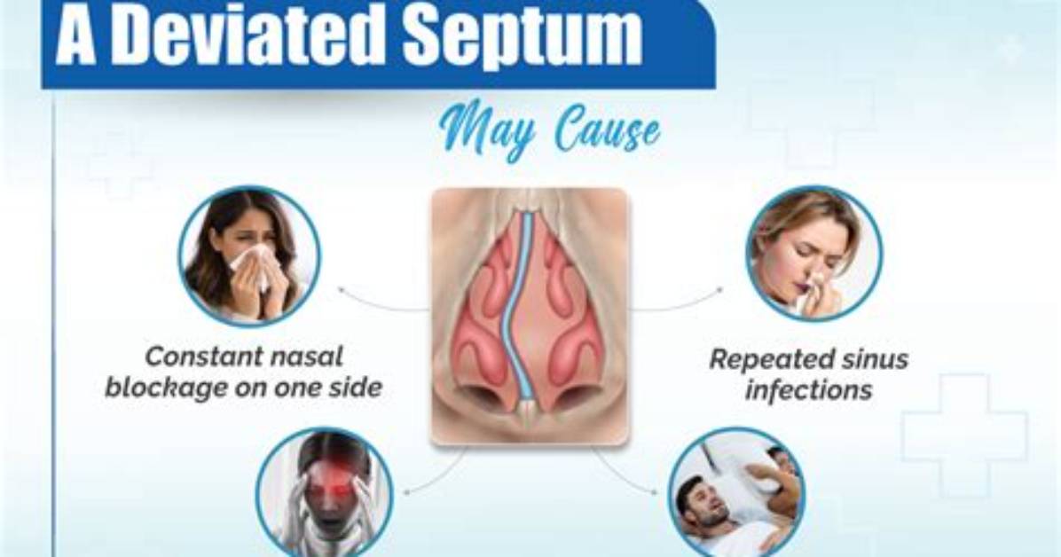 Can Deviated Septum Cause Fatigue?